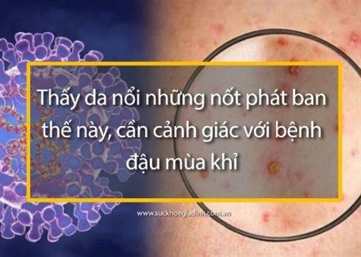 Khai trương Trang Thông tin điện tử Link Đăng Ký, Đăng Nhập EV88.com Lục quân tháng 12/2018